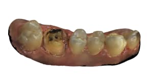 Maxillaire 17 id62 tyjhfm - Eugenol