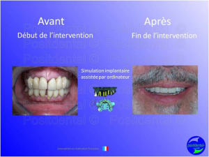 Mise en chage imm diate 027 me0yin - Eugenol