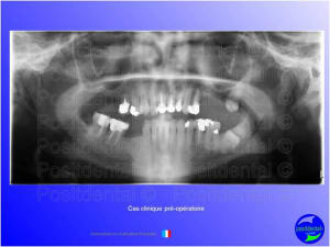 Mise en chage imm diate 058 ajpb8j - Eugenol