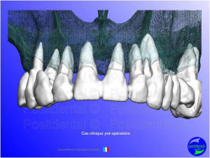 Mise en chage imm diate 059 yiu6gt - Eugenol