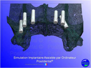 Mise en chage imm diate 097 x3nmws - Eugenol