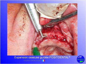 Mise en chage imm diate 150 itolcq - Eugenol