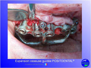 Mise en chage imm diate 155 h8sov5 - Eugenol