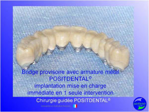 Mise en chage imm diate 169 kyvy9j - Eugenol