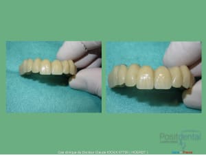 Mise en charge immédiade c - Eugenol