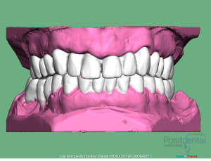 Mise en charge immédiade c - Eugenol