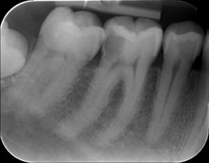 Nait 20120213 cwyhuy - Eugenol
