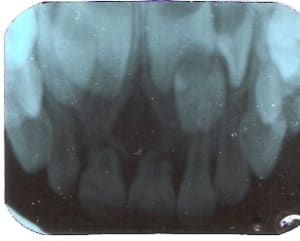 Numériser0002 cyclol - Eugenol