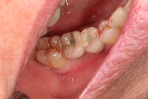 Oim bas droite xvndix - Eugenol