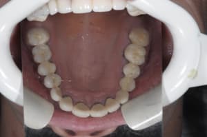 Osavant v1ske4 - Eugenol