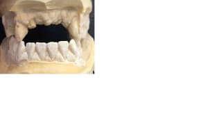 Occlusion de face u2kq2d - Eugenol