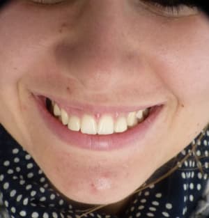 P1000226 bnooi1 - Eugenol