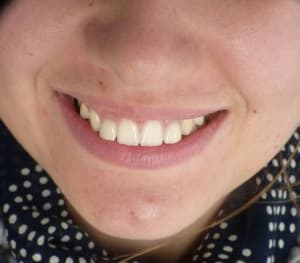 P1000227 nkjdja - Eugenol