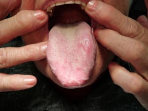 P6010081 ppiult - Eugenol