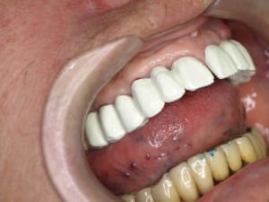P6106707 mui7uh - Eugenol