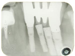 Pa050198 wekqwk - Eugenol