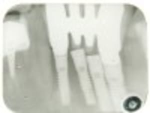 Pa050198 wekqwk jsnyl5 - Eugenol