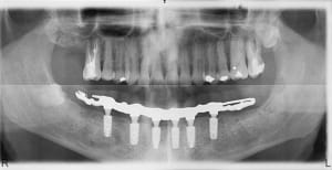 Pano 3 levbg7 - Eugenol