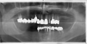 Pano1 lm7ctn - Eugenol