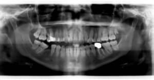 Pano dda1bw - Eugenol