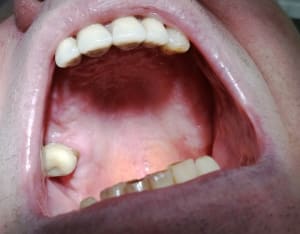 Pap wxsw0b - Eugenol