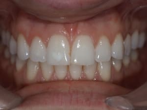 Pb070648 u1ejlm - Eugenol