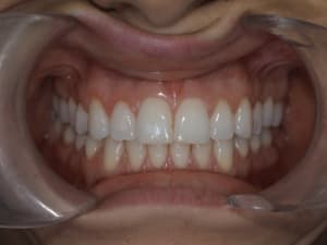 Pb070651 i8hyxt - Eugenol