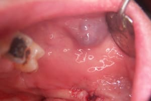 Photo 001 oqy6ue - Eugenol