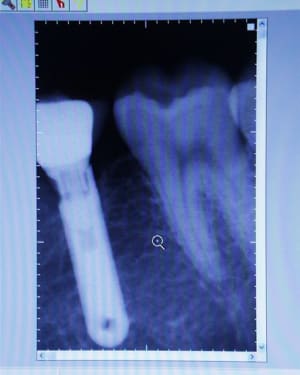 Pic00025 ek0b4z - Eugenol