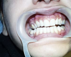 Pic00038 mqsvl8 - Eugenol
