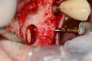 Pict1524 uo3alj - Eugenol