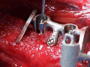 Positdental 141229 100 dhc7mt - Eugenol