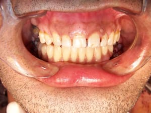 Positdental 141229 174 wtkgp7 - Eugenol