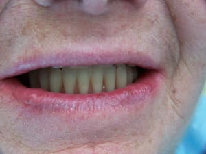 Positdental 14 08 19 072 rxmb2g - Eugenol