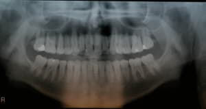 P img 1458 oyjqgr - Eugenol