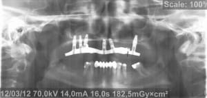 Pano 2 h2rj1y - Eugenol