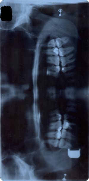 Panoramique2 lqvmxw - Eugenol