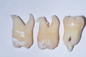 Photo 001 u823wm - Eugenol