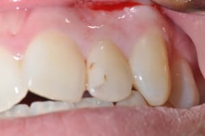 Photo 015 hm6z8r - Eugenol