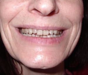 Photo 068 z7vjhn - Eugenol