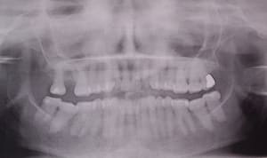 Photo 082 svxv4k - Eugenol