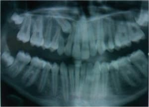 Picture3 qhwhim - Eugenol