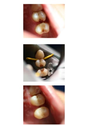 Planche contact 1 trq1fh - Eugenol