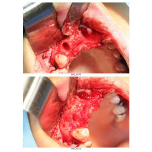 Planche contact 2 mucrxn - Eugenol