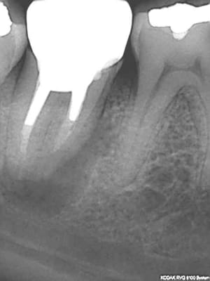 R22 dolwrh - Eugenol