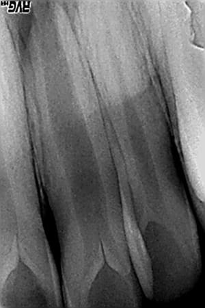 R2 qc9rlm - Eugenol
