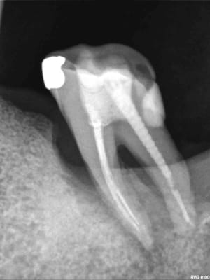 R71 yby2cf - Eugenol