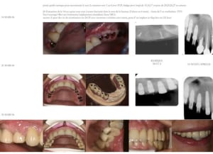 Recap il7smm - Eugenol