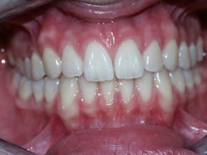 Rim ozybtq - Eugenol