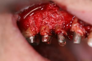 Rog np0cg1 - Eugenol